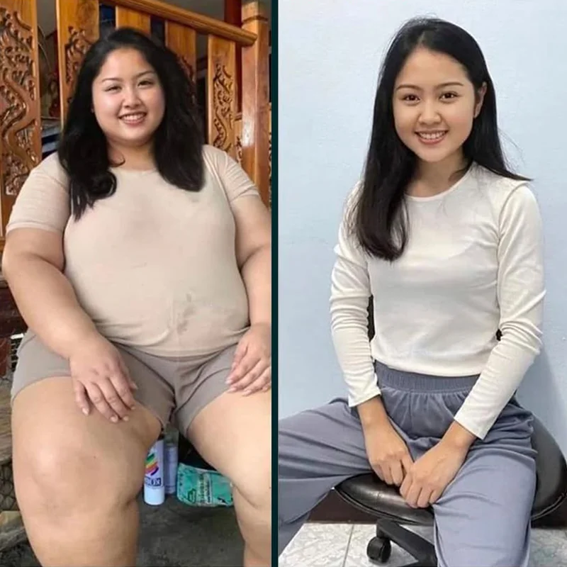 Before and after comparison of woman's weight loss transformation, wearing casual clothing