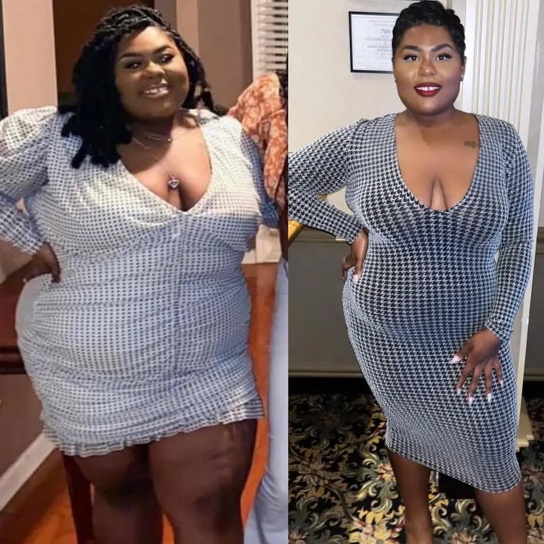 Side-by-side weight loss transformation comparison of same woman in matching patterned dress